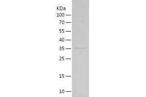 Western Blotting (WB) image for Cholinergic Receptor, Nicotinic, alpha 7 (Neuronal) (CHRNA7) (AA 25-129) protein (His-IF2DI Tag) (ABIN7122359)