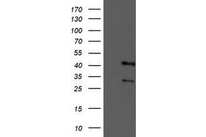 Western Blotting (WB) image for anti-Tropomodulin 1 (TMOD1) antibody (ABIN1501528) (Tropomodulin 1 anticorps)