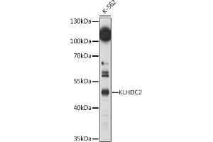 Western blot analysis of extracts of K-562 cells, using KLHDC2 antibody (ABIN7268073) at 1:1000 dilution. (KLHDC2 anticorps  (AA 1-240))