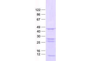 Validation with Western Blot (Cyclin-Dependent Kinase 15 (ALS2CR7) protein (His tag))