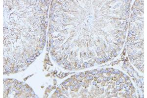 ABIN6279778 at 1/100 staining Mouse testis tissue by IHC-P. (RND2 anticorps  (Internal Region))