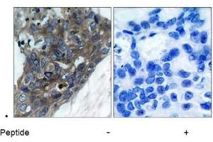 Image no. 1 for anti-Mitogen-Activated Protein Kinase Kinase Kinase 5 (MAP3K5) (Ser966) antibody (ABIN197326)