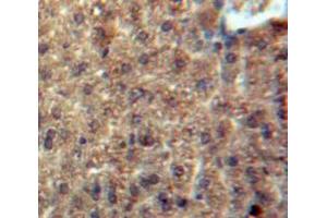 Used in DAB staining on fromalin fixed paraffin-embedded Liver tissue (CCL3L1 anticorps  (AA 1-93))