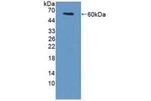 Detection of Recombinant TGM1, Mouse using Polyclonal Antibody to Transglutaminase 1 (TGM1) (TGM1 anticorps  (AA 337-607))