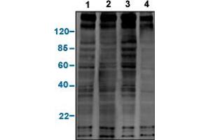 Western blot analysis of a panel of phosphotyrosine antibodies with EGF-stimulated A431 cell lysates. (Phosphotyrosine anticorps)