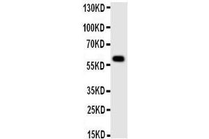 Western Blotting (WB) image for anti-Monoamine Oxidase A (MAOA) (AA 51-69), (N-Term) antibody (ABIN3043133) (Monoamine Oxidase A anticorps  (N-Term))