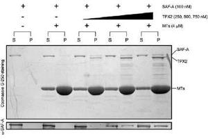 Bioactivity measured with Activity Assay