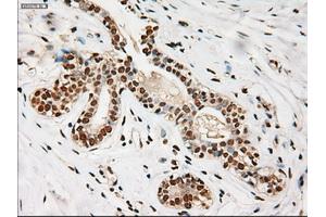 Immunohistochemical staining of paraffin-embedded breast using anti-Notch1 (ABIN2452671) mouse monoclonal antibody. (Notch1 anticorps  (AA 2300-2556))