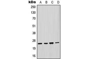 Western blot analysis of GSTM2 expression in HepG2 (A), HeLa (B), mouse liver (C), rat liver (D) whole cell lysates. (GSTM2 anticorps  (Center))