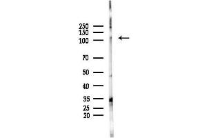 anti-Ubiquitin-Like Modifier Activating Enzyme 7 (UBA7) (C-Term) antibody