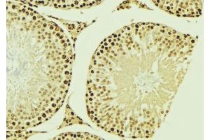 ABIN6276953 at 1/100 staining Mouse testis tissue by IHC-P. (MNAT1 anticorps  (N-Term))