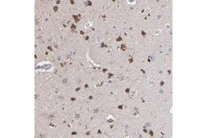 Immunohistochemical staining of human cerebral cortex with MAGEE1 polyclonal antibody  shows strong cytoplasmic positivity in neuronal cells at 1:20-1:50 dilution. (MAGEE1 anticorps)