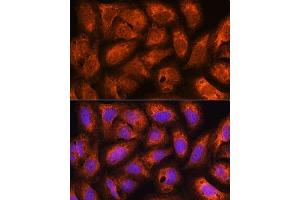 Immunofluorescence analysis of U2OS cells using  Rabbit pAb  at dilution of 1:100.