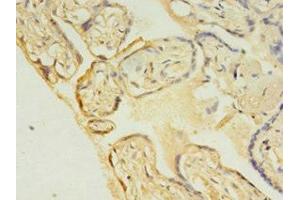 Immunohistochemistry of paraffin-embedded human placenta tissue using ABIN7174430 at dilution of 1:100