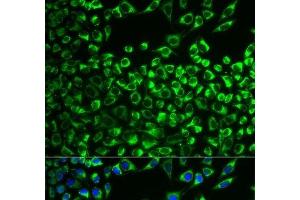 Immunofluorescence analysis of MCF-7 cells using CYP51A1 Polyclonal Antibody (CYP51A1 anticorps)