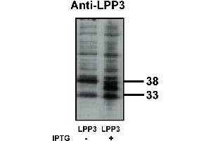 Western blot analysis using LPP3 antibody on bacterially expressed LPP3 protein when untreated (-) and treated with with 0. (PPAP2B anticorps)