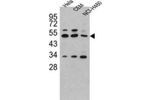 Western Blotting (WB) image for anti-Carboxypeptidase A4 (CPA4) antibody (ABIN3003151)