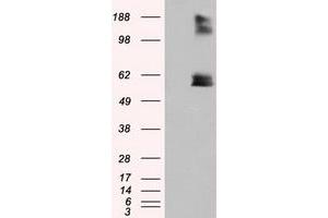 Image no. 2 for anti-Lipase, Endothelial (LIPG) antibody (ABIN1499175) (LIPG anticorps)
