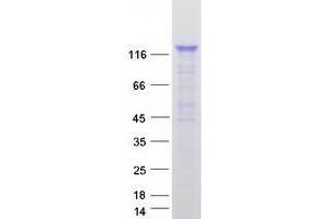 Validation with Western Blot