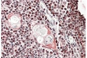 AP23696PU-N SATB1 Antibody staining of of paraffin embedded Human Thymus at 3. (SATB1 anticorps  (Internal Region))