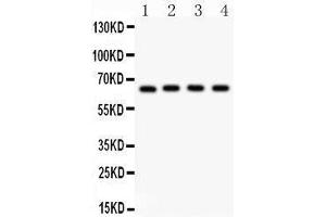 Anti- NF-kB p65 Picoband antibody, Western blotting All lanes: Anti NF-kB p65  at 0. (NF-kB p65 anticorps  (AA 291-479))