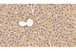 Detection of NNMT in Mouse Liver Tissue using Polyclonal Antibody to Nicotinamide-N-Methyltransferase (NNMT) (NNMT anticorps  (AA 1-264))