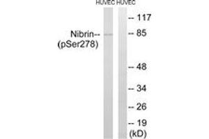 Western blot analysis of extracts from HuvEc cells treated with Forskolin 40nM 30', using Nibrin (Phospho-Ser278) Antibody. (Nibrin anticorps  (pSer278))