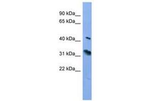 Image no. 1 for anti-Rhodopsin (RHO) (C-Term) antibody (ABIN6746706) (Rhodopsin anticorps  (C-Term))