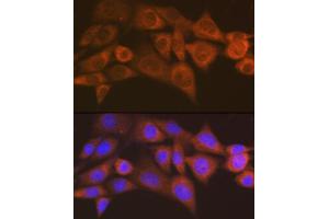Immunofluorescence analysis of NIH/3T3 cells using  antibody (ABIN7265552) at dilution of 1:100.