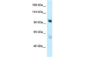 WB Suggested Anti-EDEM3 Antibody Titration: 1.