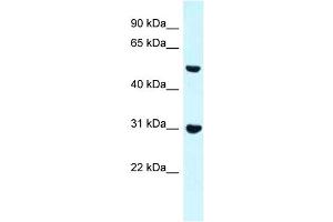 WB Suggested Anti-Fnbp1 Antibody Titration: 1. (FNBP1 anticorps  (N-Term))