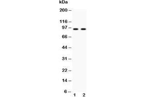 Western blot testing of Cadherin 17 antibody and Lane 1:  HeLa;  2: SW620 lysate (LI Cadherin anticorps  (AA 686-699))