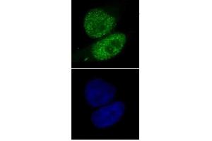 SMARCA4 antibody (mAb) (Clone 5B7) tested by immunofluorescence. (SMARCA4 anticorps  (AA 213-295))