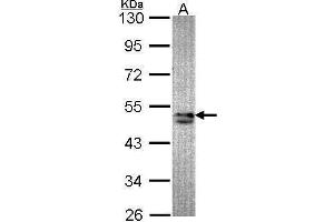 WB Image Sample (30 ug of whole cell lysate) A: A549 10% SDS PAGE antibody diluted at 1:1000 (SNX15 anticorps  (C-Term))