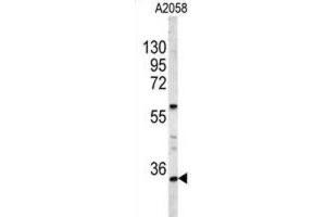 Western Blotting (WB) image for anti-Homeobox A9 (HOXA9) antibody (ABIN3004038)