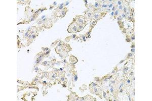 Immunohistochemistry of paraffin-embedded Human lung using MMRN1 Polyclonal Antibody at dilution of 1:100 (40x lens).