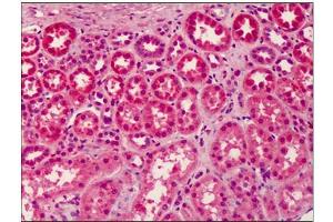 Human Kidney: Formalin-Fixed, Paraffin-Embedded (FFPE) (LGI3 anticorps  (Center))