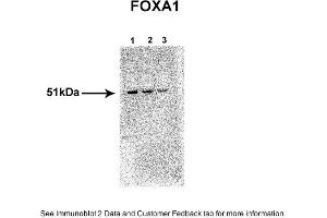Sample Type: 1. (FOXA1 anticorps  (N-Term))