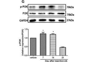 The CXCR7 and PI3K/Akt signaling pathways are involved in CPSP in the dorsal horn of the spinal cord. (GAPDH anticorps)
