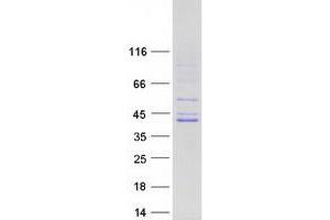 Validation with Western Blot