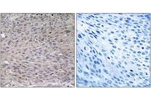 Immunohistochemistry analysis of paraffin-embedded human thyroid gland, using IREB1 (Phospho-Ser711) Antibody.