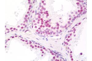 Anti-THRAP3 / TRAP150 antibody IHC staining of human prostate. (THRAP3 anticorps  (C-Term))