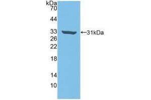 Detection of Recombinant Rock2, Human using Polyclonal Antibody to Rho Associated Coiled Coil Containing Protein Kinase 2 (Rock2) (ROCK2 anticorps  (AA 904-1140))