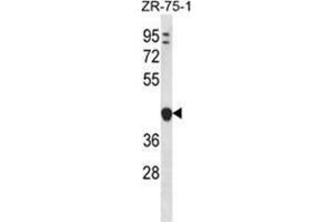 YIPF1 Antibody (N-term) western blot analysis in ZR-75-1 cell line lysates (35 µg/lane). (YIPF1 anticorps  (N-Term))