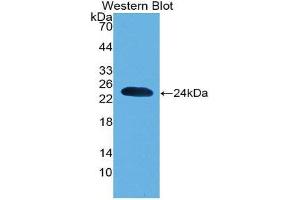 Western Blotting (WB) image for anti-Parkinson Protein 7 (PARK7) (AA 1-189) antibody (ABIN1078423)