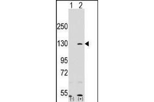 Western blot analysis of RP1 (arrow) using rabbit polyclonal RP1 Antibody (N-term) (ABIN390353 and ABIN2840765). (PARP1 anticorps  (N-Term))