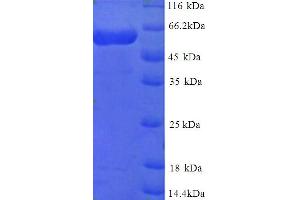 Multiple Inositol-Polyphosphate Phosphatase 1 (MINPP1) (AA 31-487) protein (His tag)
