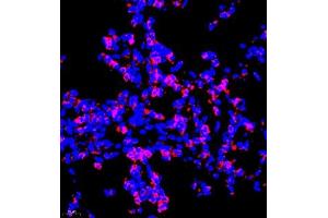 Immunofluorescence of paraffin embedded rat lung using P4H (ABIN7074215) at dilution of 1:700 (400x lens) (HIF Prolyl Hydroxylase anticorps)