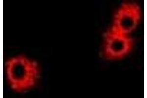 Immunofluorescent analysis of PHPT1 staining in Hela cells.