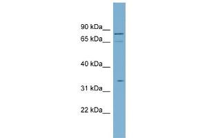 WB Suggested Anti-SLC5A9 Antibody Titration:  0. (SLC5A9 anticorps  (N-Term))